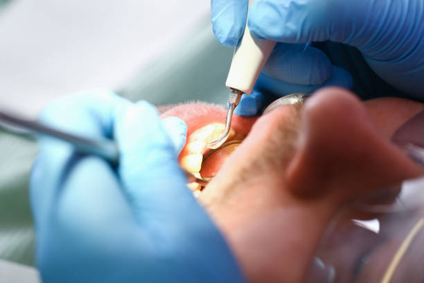 Best Cracked Tooth Emergency Dentist  in Hwatha, IA